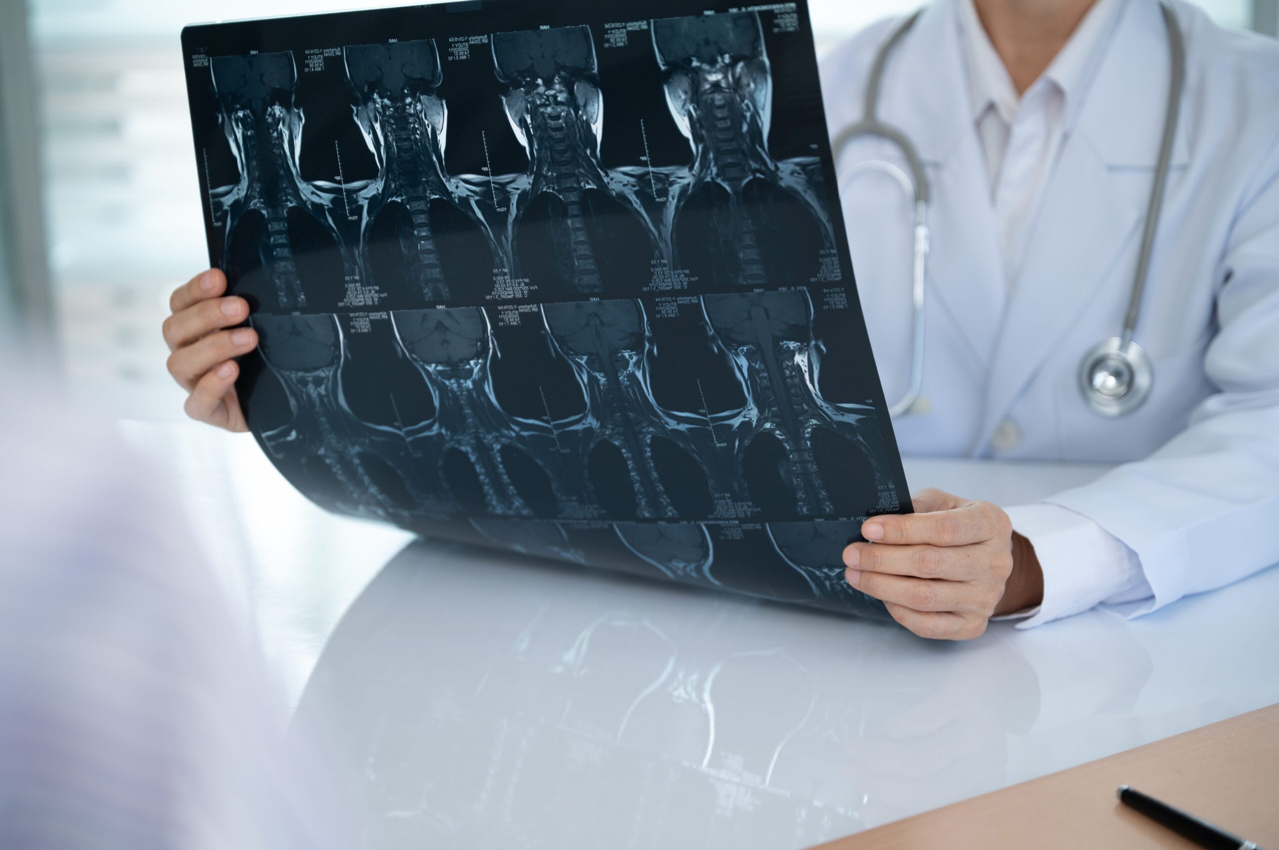 Orthopedist checkup cervical spine x-ray film and diagnose cervical care at doctor room.